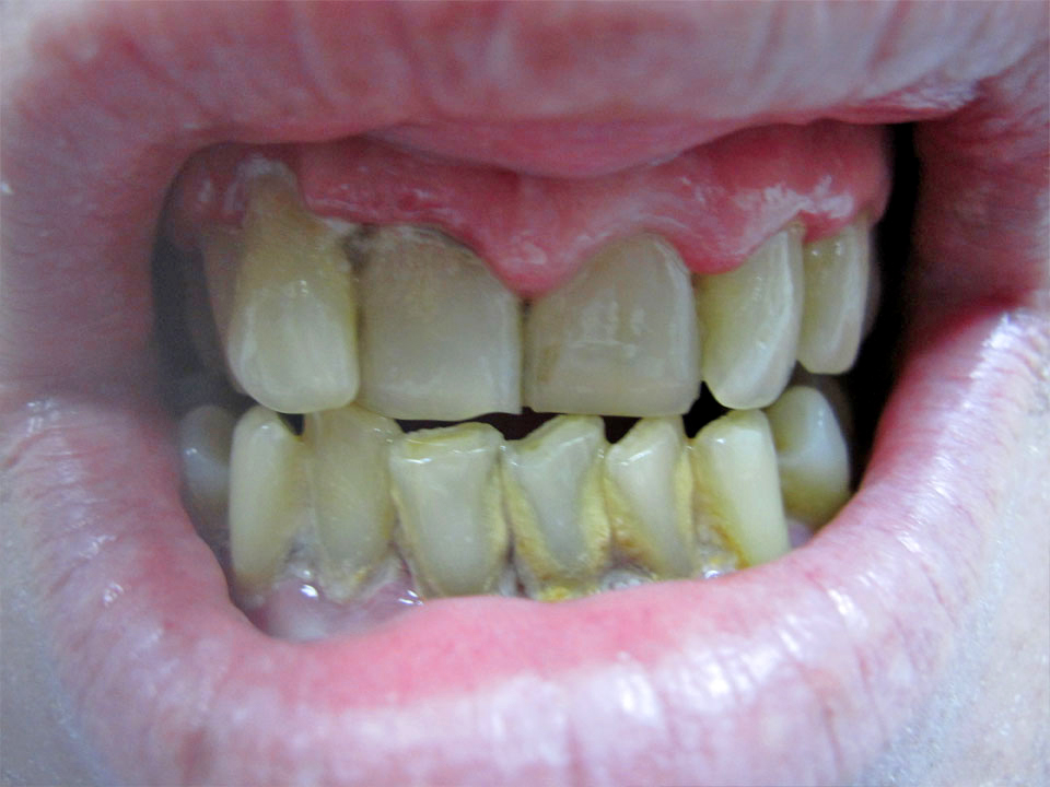 Before image