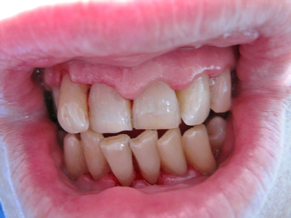 After image