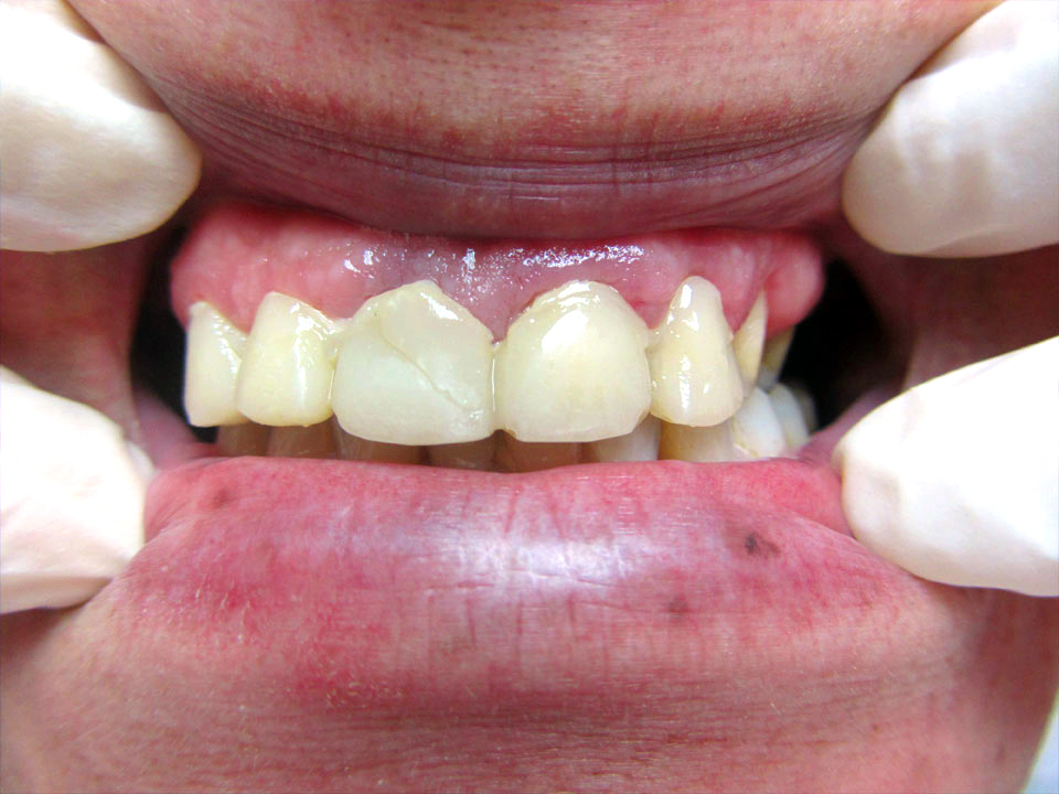 Before image